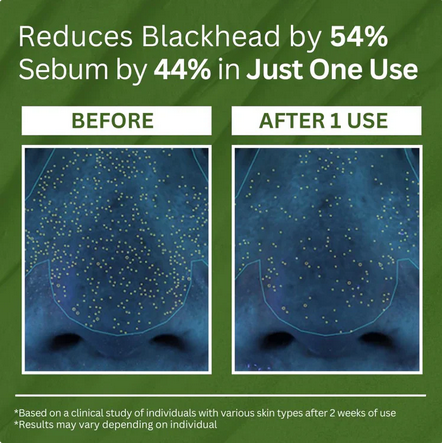PURAVEA™ Basil Bubble Detox Mask - PURAVEA